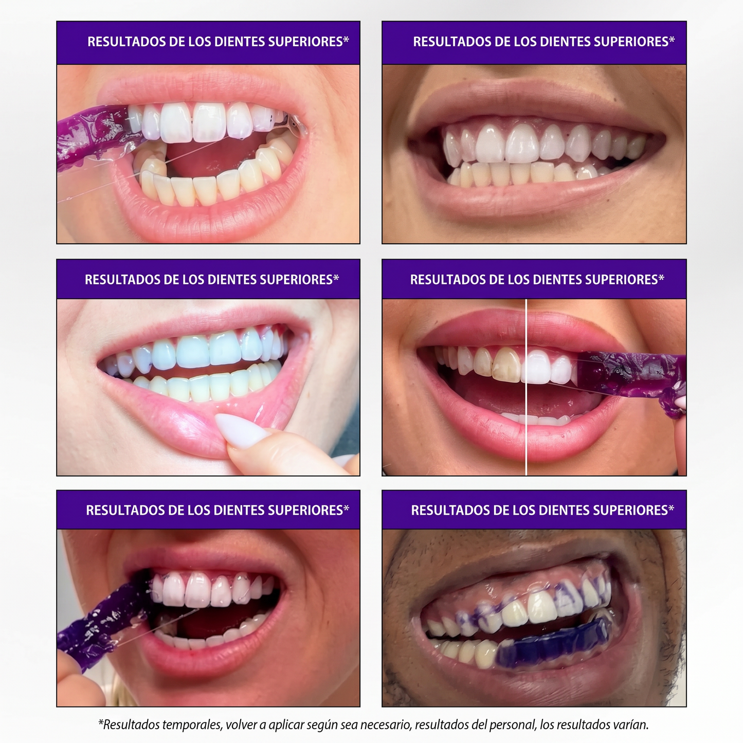 Hismile® Tiras Blanqueadoras Dentales