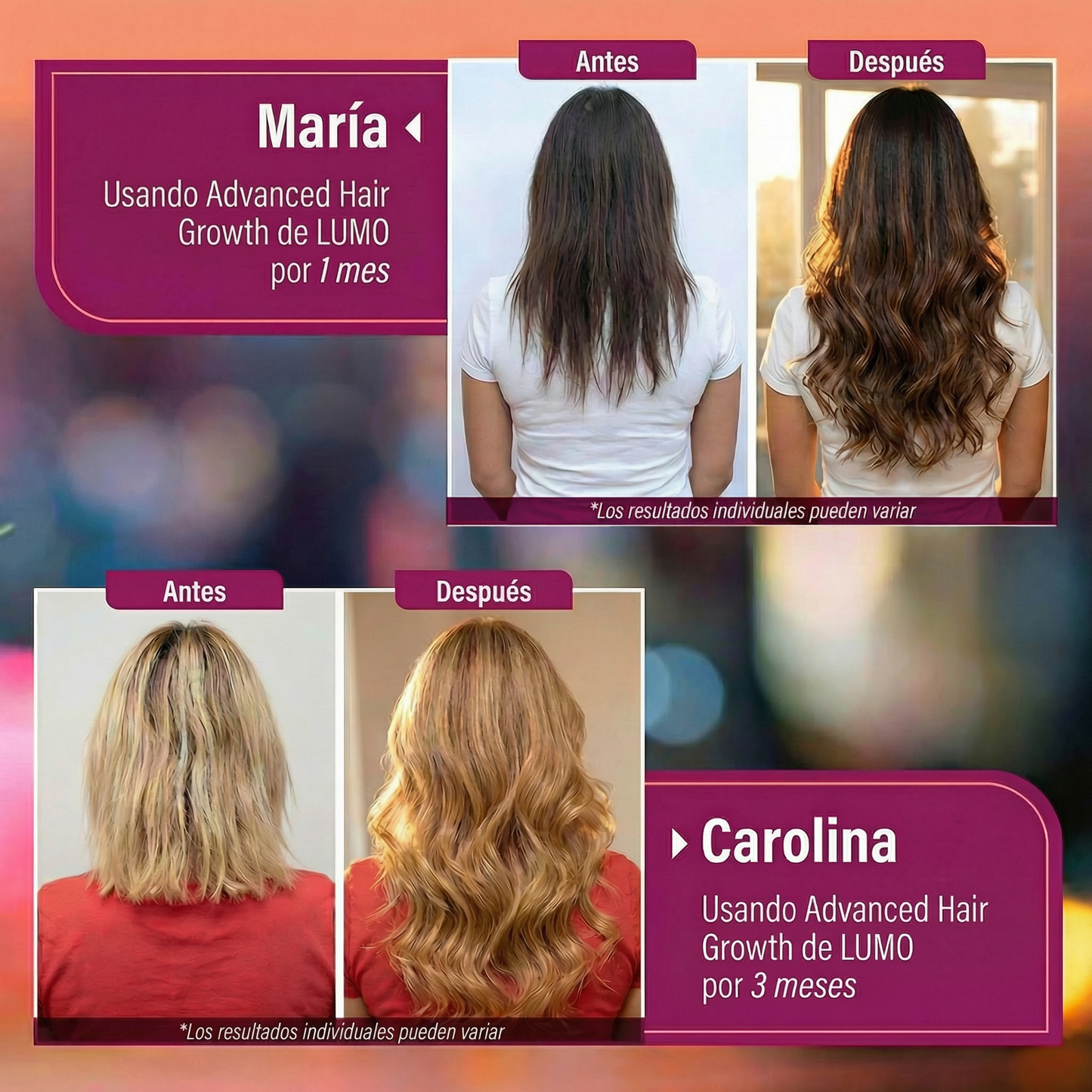 Advanced Hair Growth® (120 Cápsulas)