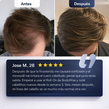 Bodywise® Serum Roll-On